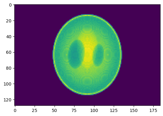 Simulated projection of the phantom test volume.